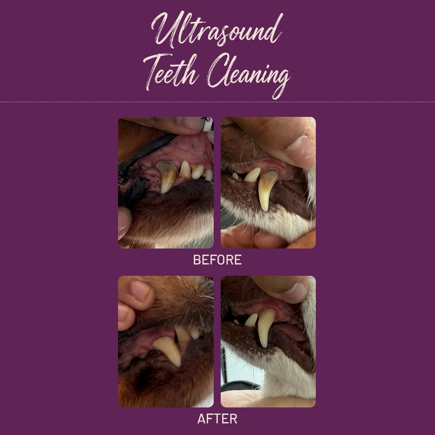 Ultrasound Teeth Cleaning | E20 1BD