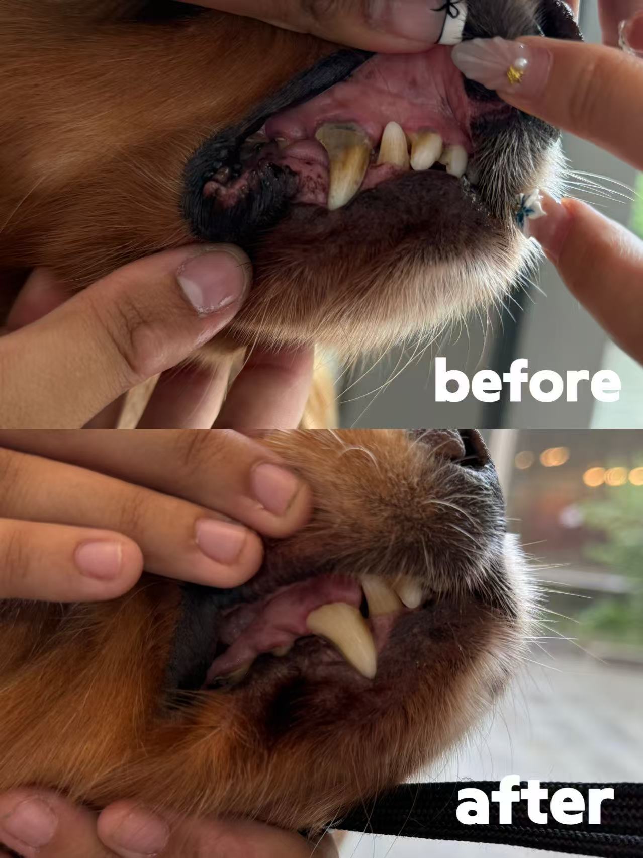 Ultrasound Teeth Cleaning | E20 1BD