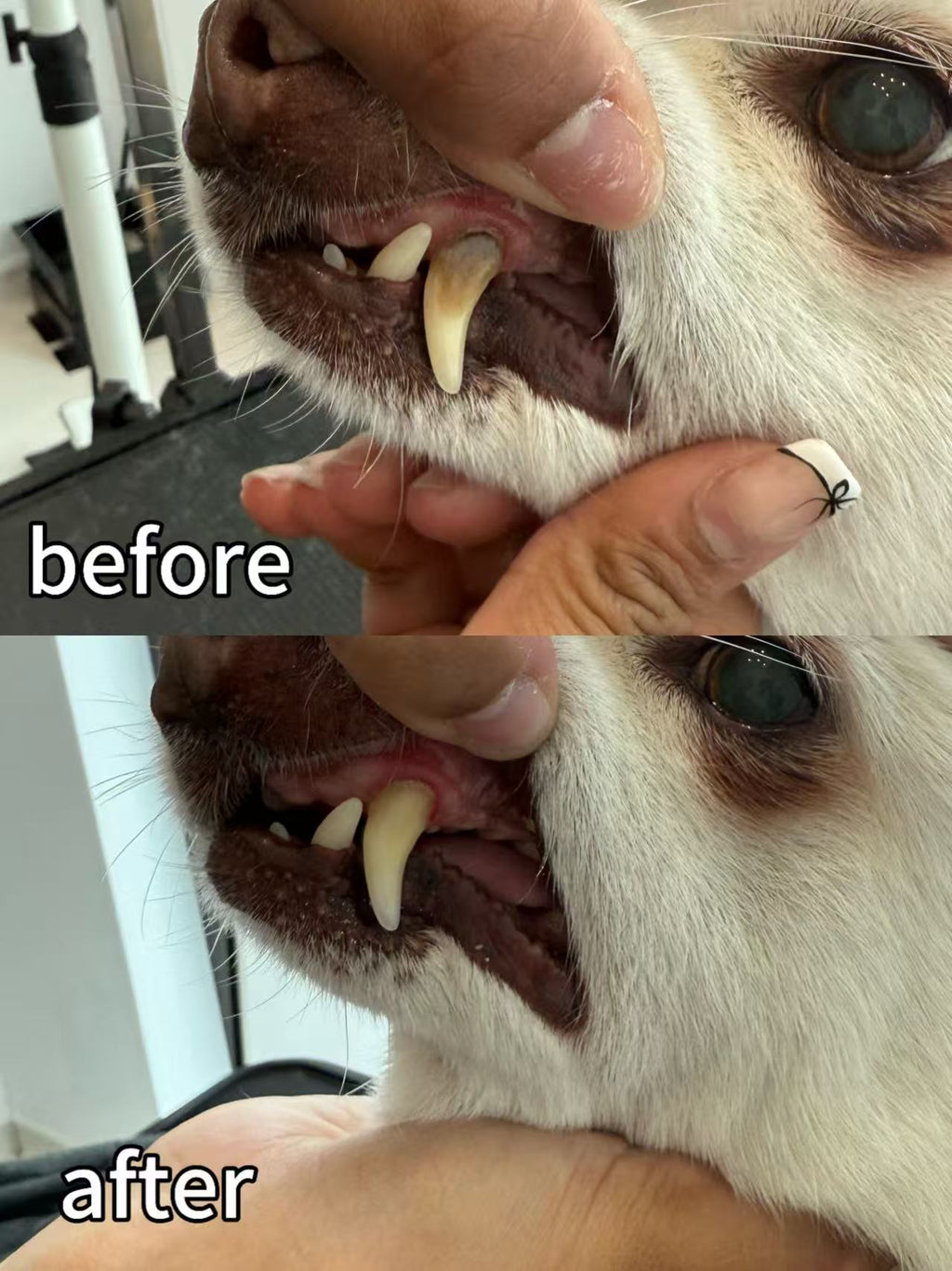 Ultrasound Teeth Cleaning | E20 1BD