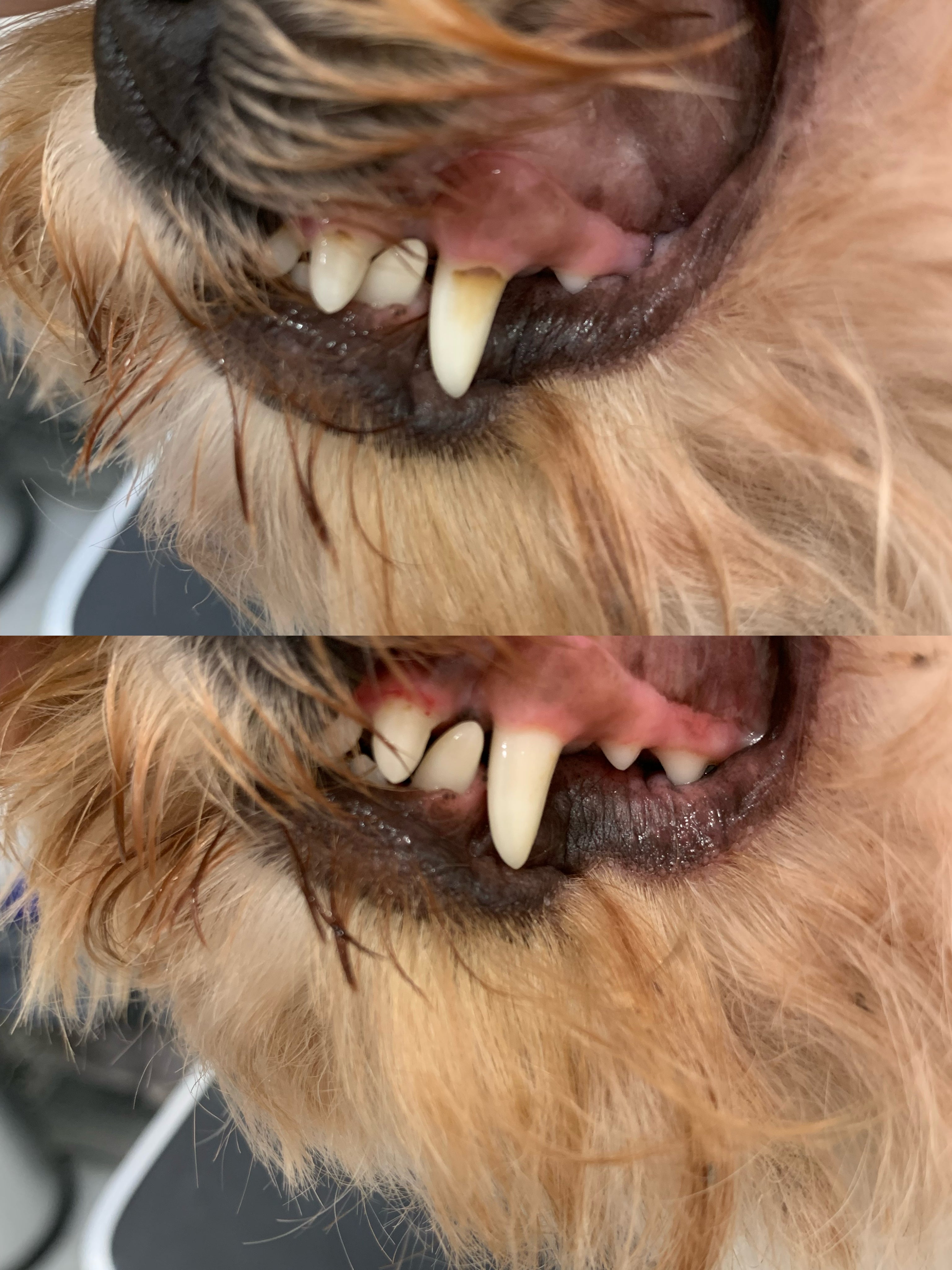 Ultrasound Teeth Cleaning | E20 1BD